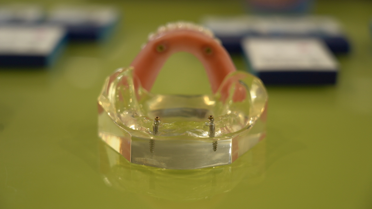 Thailand succeeds in developing low-cost artificial tooth roots
